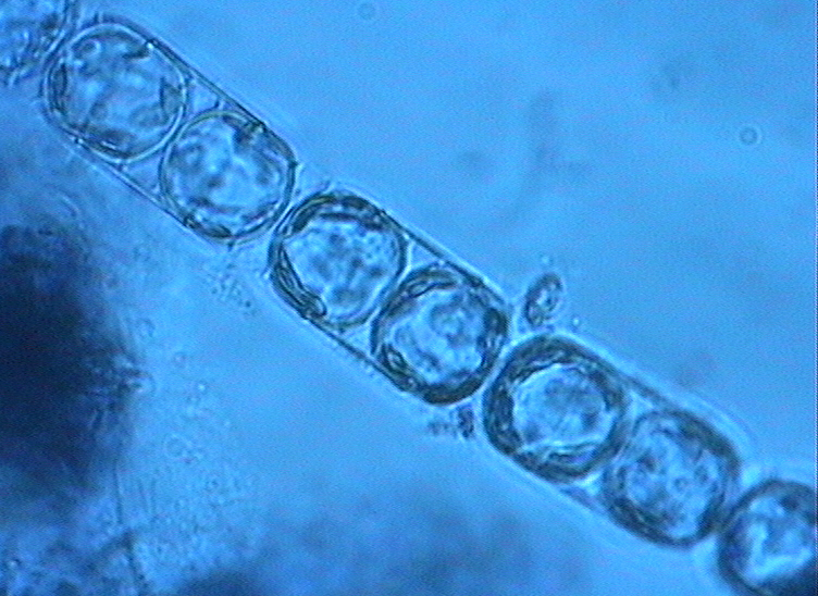Dictyocha speculum